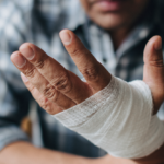 man with hand injury